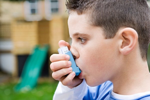 شاخص توده بدنی عامل تعیین کننده ریسک ابتلا به آسم در کودکی