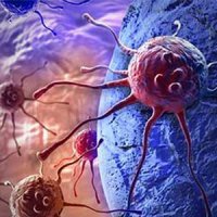 تخریب سلول های سرطانی به کمک نانوذرات و امواج فراصوت