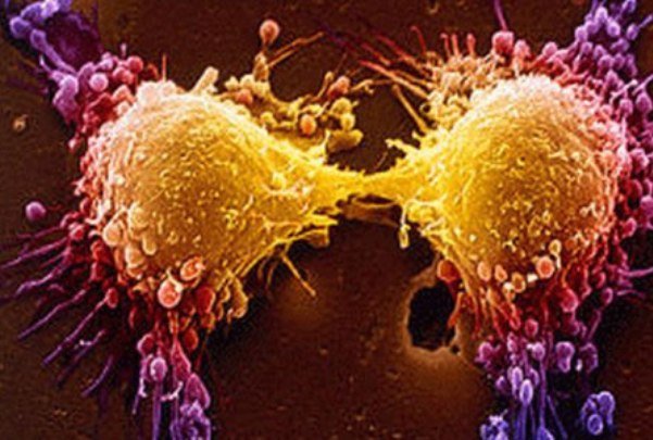 استفاده از «تستوسترون» برای درمان موفقیت آمیز سرطان