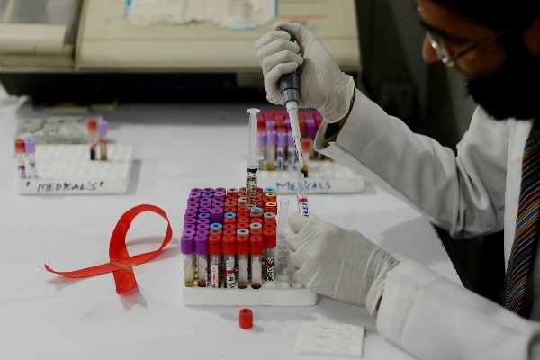 آغاز آزمایش واکسن جدید HIV در جنوب آفریقا