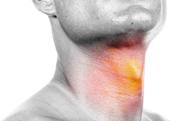 گرفتگی صدا را جدی بگیرید/ ارتباط سیگار و سرطان حنجره