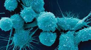تشخیص سلول های سرطانی متاستاتیک بدخیم از سلول های معمولی