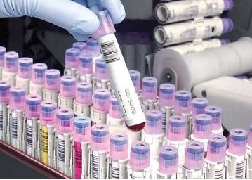 ذخیره سازی ۱۱۰ هزار نمونه در بانک خون بندناف رویان/ بالاترین ظرفیت سلولی در خاورمیانه