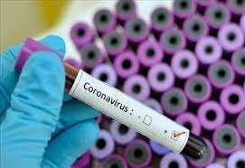 آلودگی کیت‌های آزمایش ویروس کرونا در آمریکا