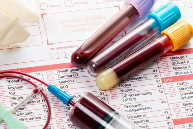 آزمایش خون ۵۰ نوع سرطان را شناسایی می کند