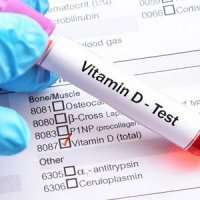 6 نشانه کمبود ویتامین D در بدن