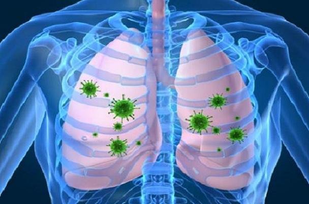 عفونت تنفسی ریسک بیماری قلبی را ۱۷ برابر افزایش می دهد