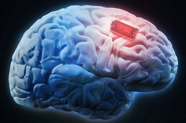 تشخیص و درمان سریع‌ بیماری‌ها با نقشه برداری مغز