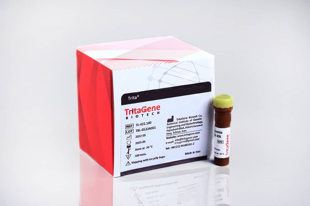 Trita® HBV Real-Time PCR Kit - Trita® HBV Real-Time PCR Kit - TritaGene - کیت - سلولی و مولکولی - تولیدی تحقیقاتی تریتاژن زیست فناور